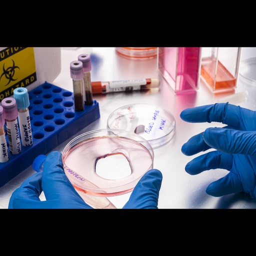 [0400-SPR-322-A594-100UG] Human E. Coli Recombinant Alpha Synuclein Protein, conj.: ATTO 594 ''Type 1''   100 ug